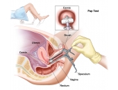 Tổng Hợp Những Điều Cần Biết Về Xét Nghiệm Ung Thư Cổ Tử Cung